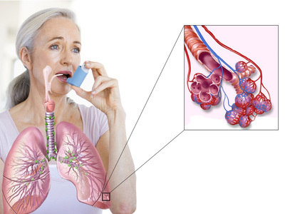 Как определить бронхиальную астму